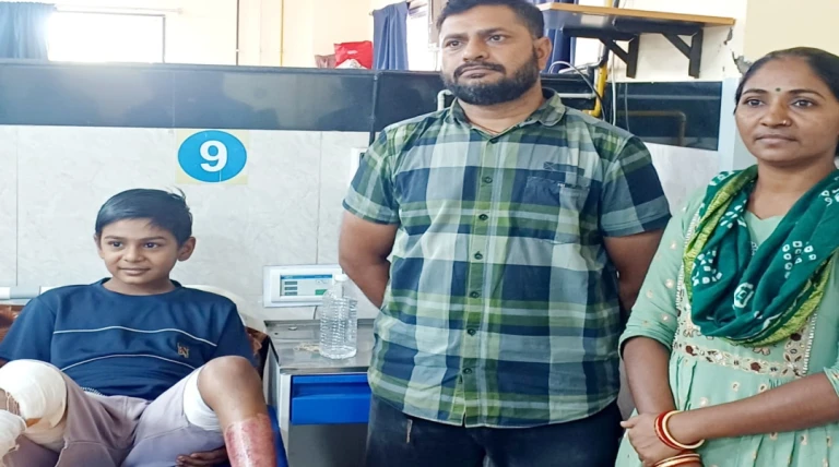 રાજકોટ સિવિલમાં પ્લાસ્ટિક સર્જરી વિભાગ: યુગની પીડાથી મુક્તિ અને બાળકની સફળ સારવાર